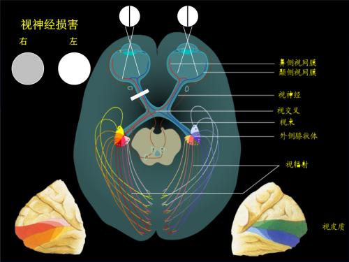 什麼叫作視神經脊髓炎疾病,導致患病的原因是什麼,患者有何症狀