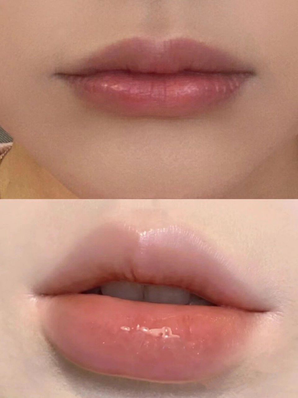 男朋友忍不住想亲我的嘴巴 丰唇之后,嘴巴肉嘟嘟的,男朋友说爱死了,总