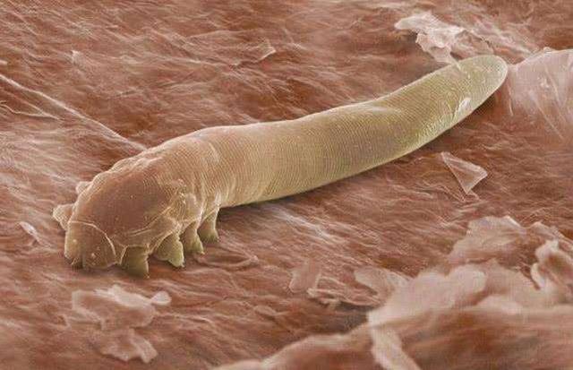 床上螨虫成堆教你个笨法子家里放它螨虫消失了