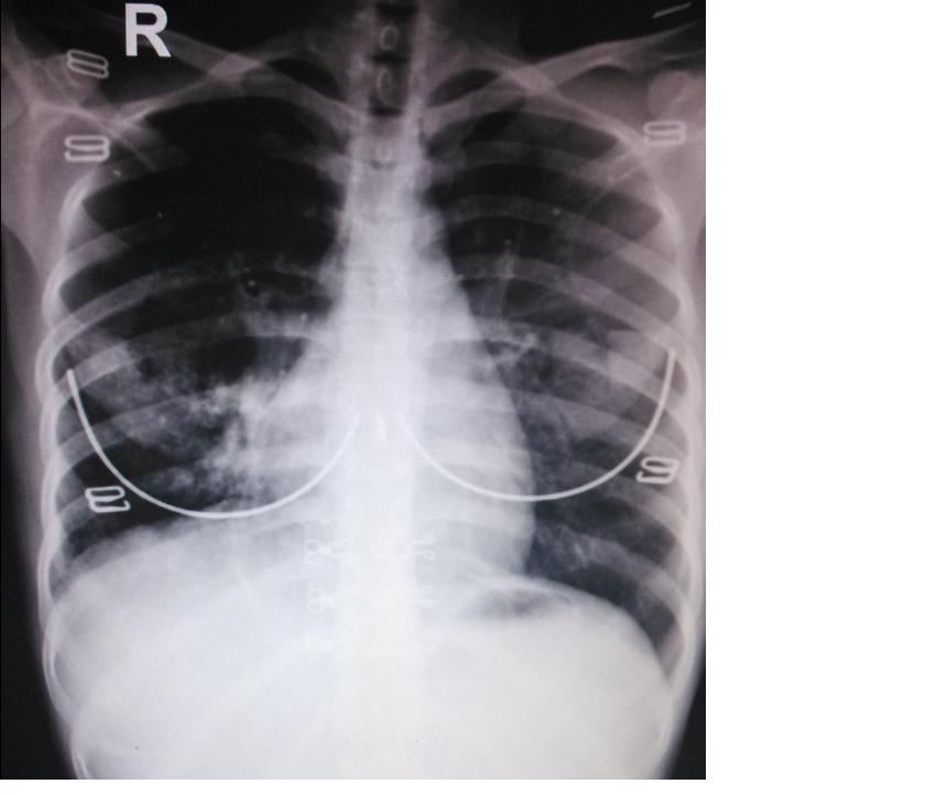胸透检查时,男医生要求女患者脱光上衣,到底是治病还是性侵?