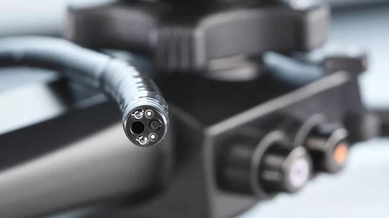 29岁女白领无症状竟然查出癌!医生:胃镜检查一定要做!