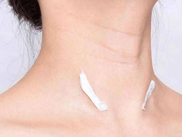 什么是"肥胖颈纹"?若你有这个困扰,不妨选择医美改善