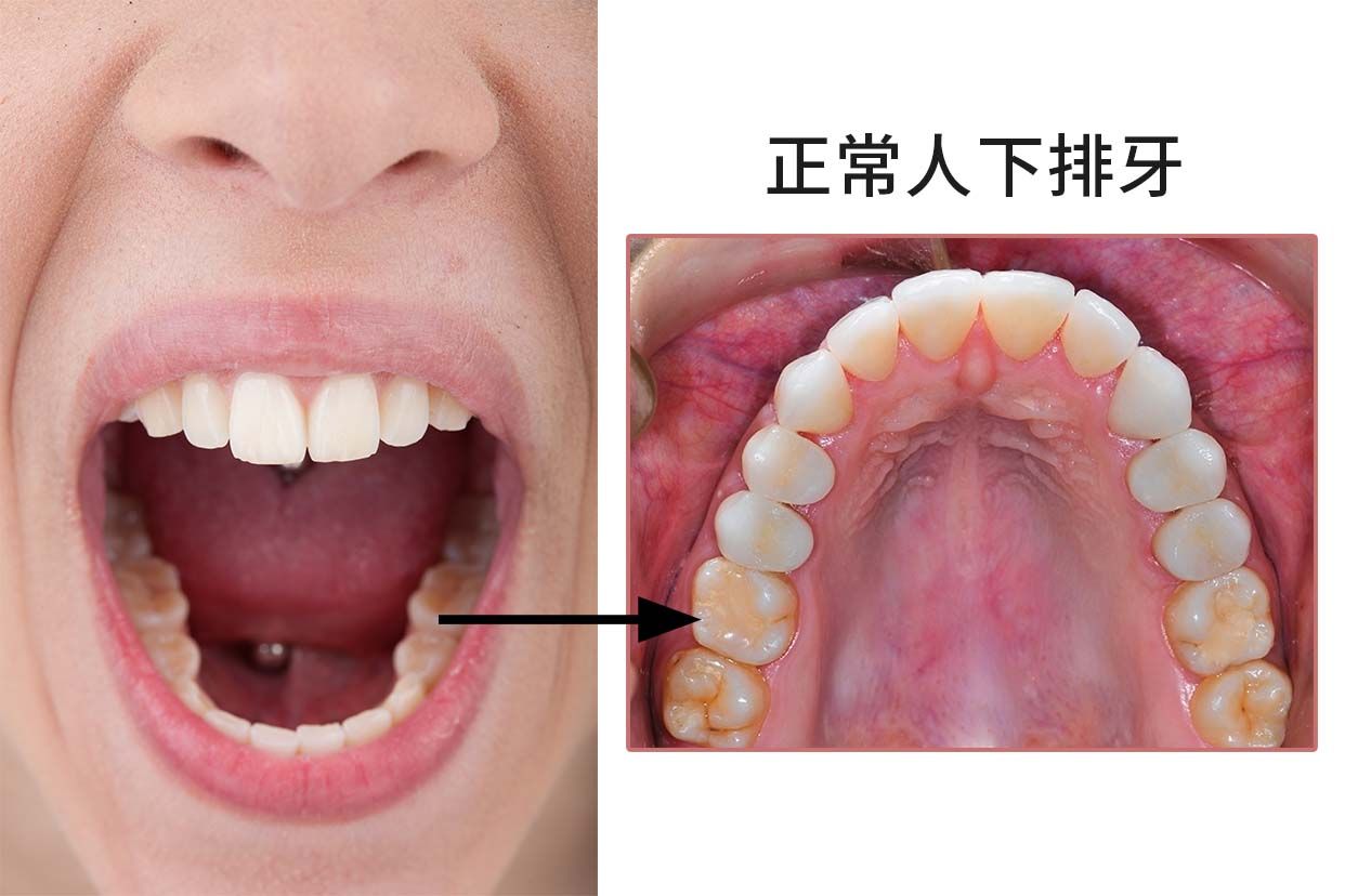 正常人下排牙图片图片