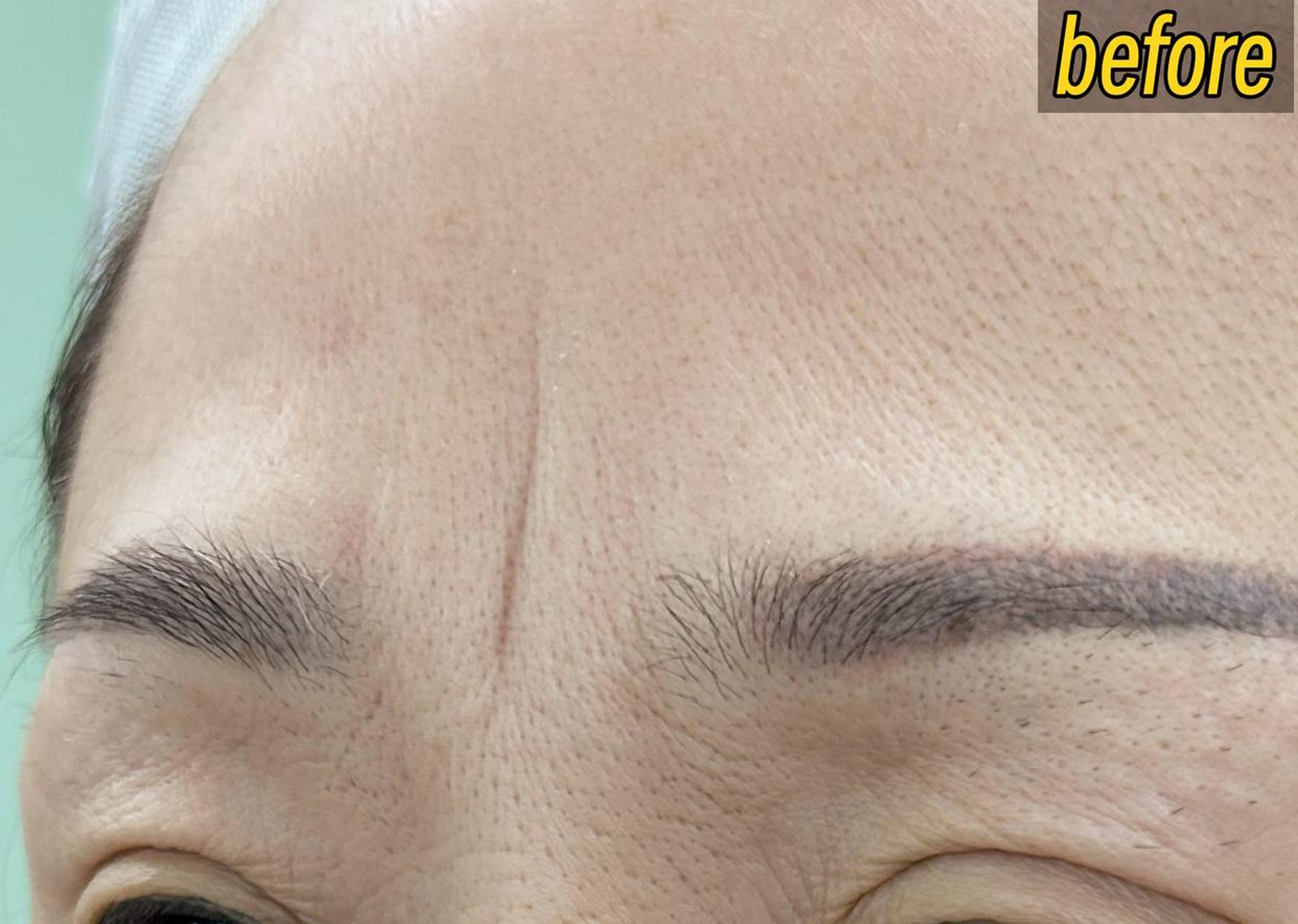 印堂悬针纹是指眉毛正中央的位置出现微小的凹陷或纹路