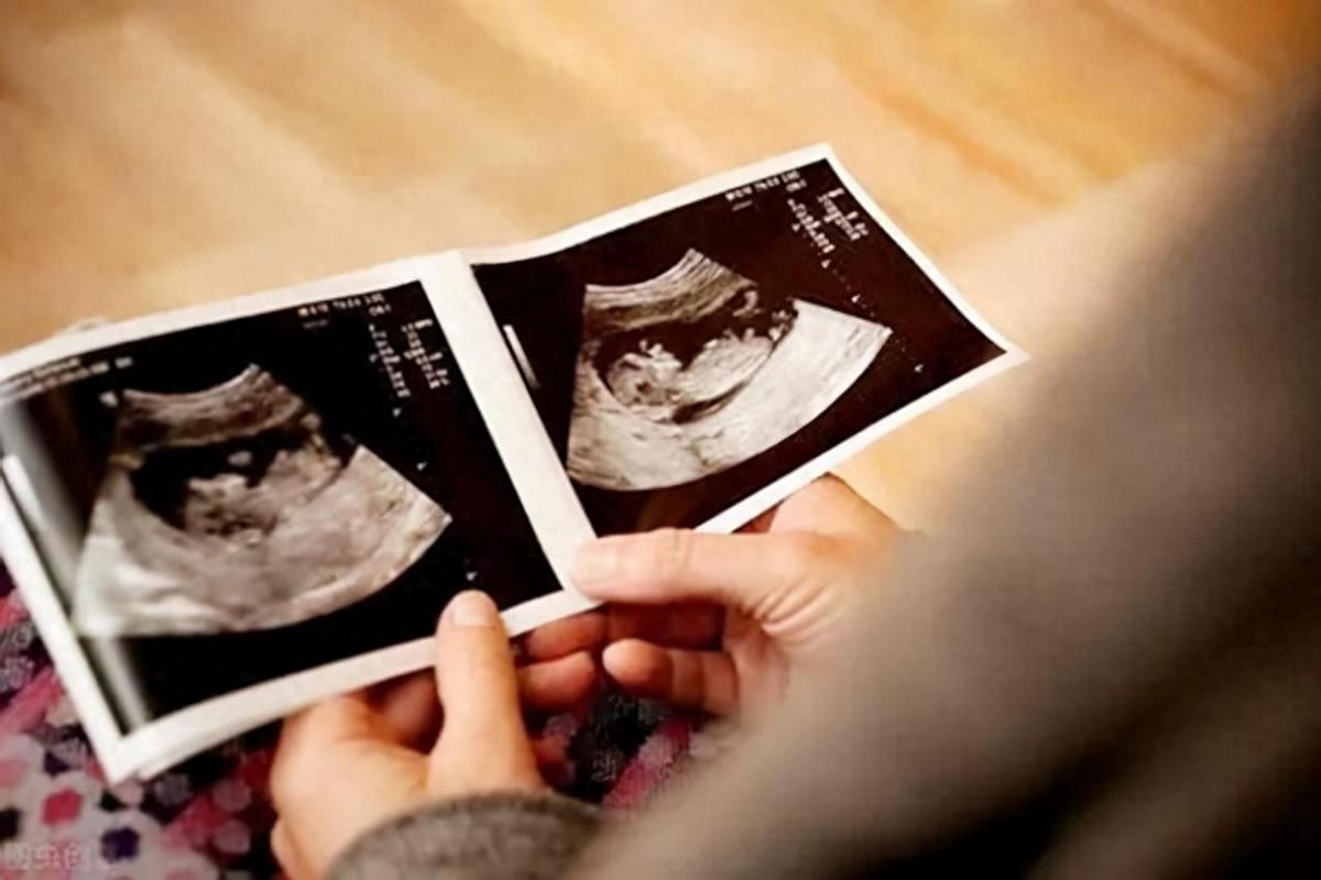 2010年女子车祸成植物人昏迷中竟怀孕生子两年后被儿子唤醒