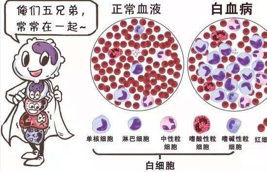 白血病怎么引起的图片