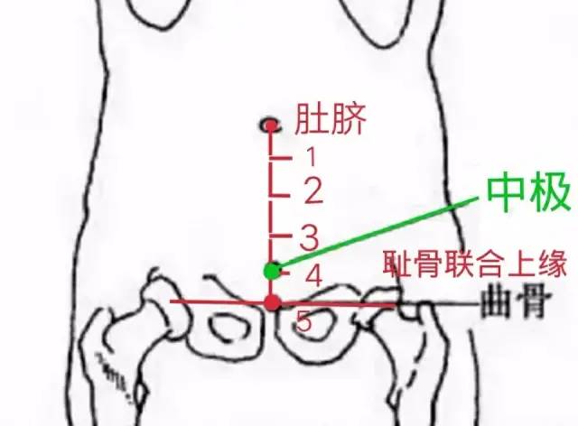 中极准确位置图 图图片