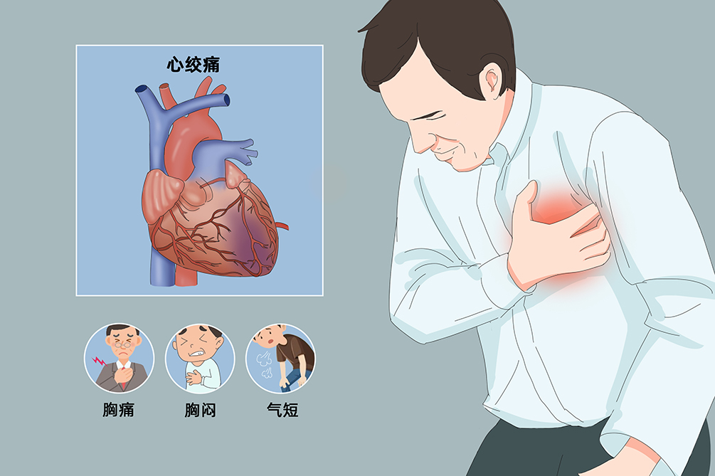 心绞痛一定会痛?医生建议:心绞痛可吃这几种食物,或有助于缓解