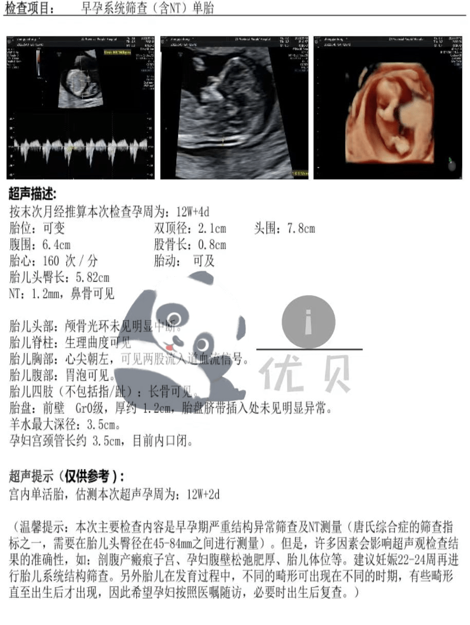 浙江省人民医院（朝晖院区）怀孕产检时间安排及产检项目介绍