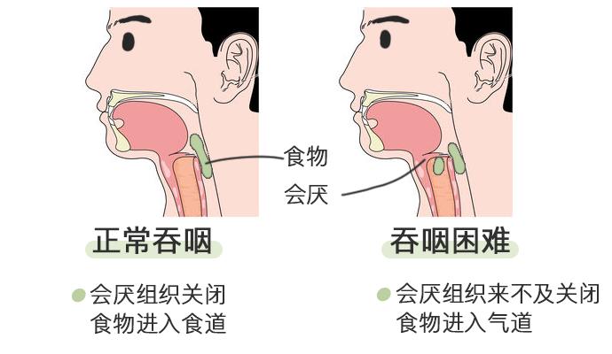 为什么会呛到