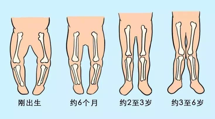 新生儿小腿弯曲图片