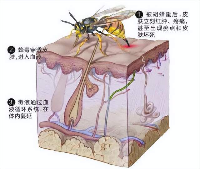 秋蜂蜇人有多可怕