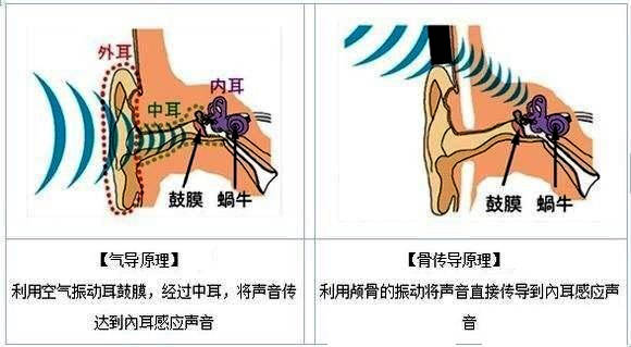 骨传导耳机结构图图片