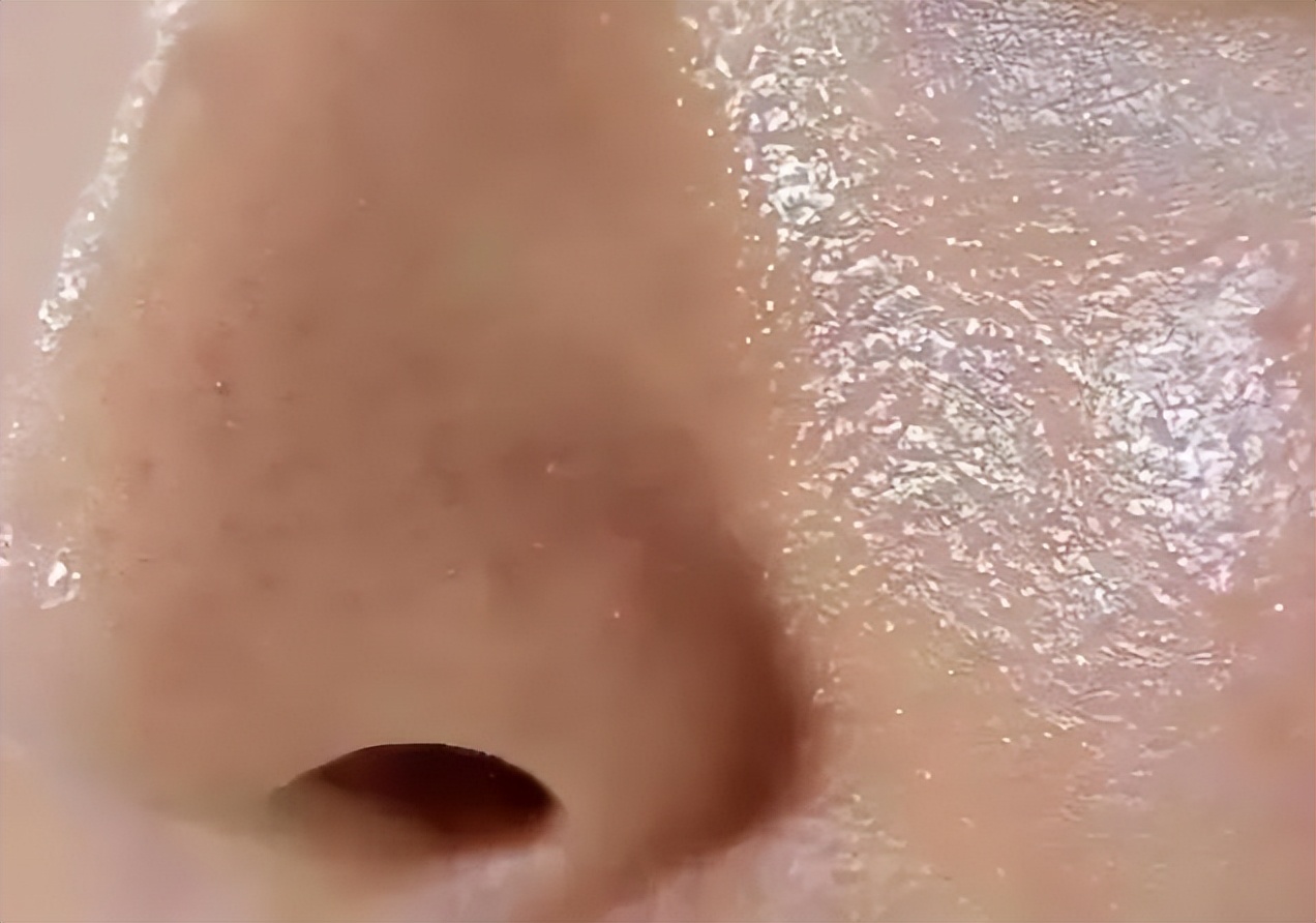 粉底液上脸不久,就氧化出油,那是因为化妆时没有加上这个步骤