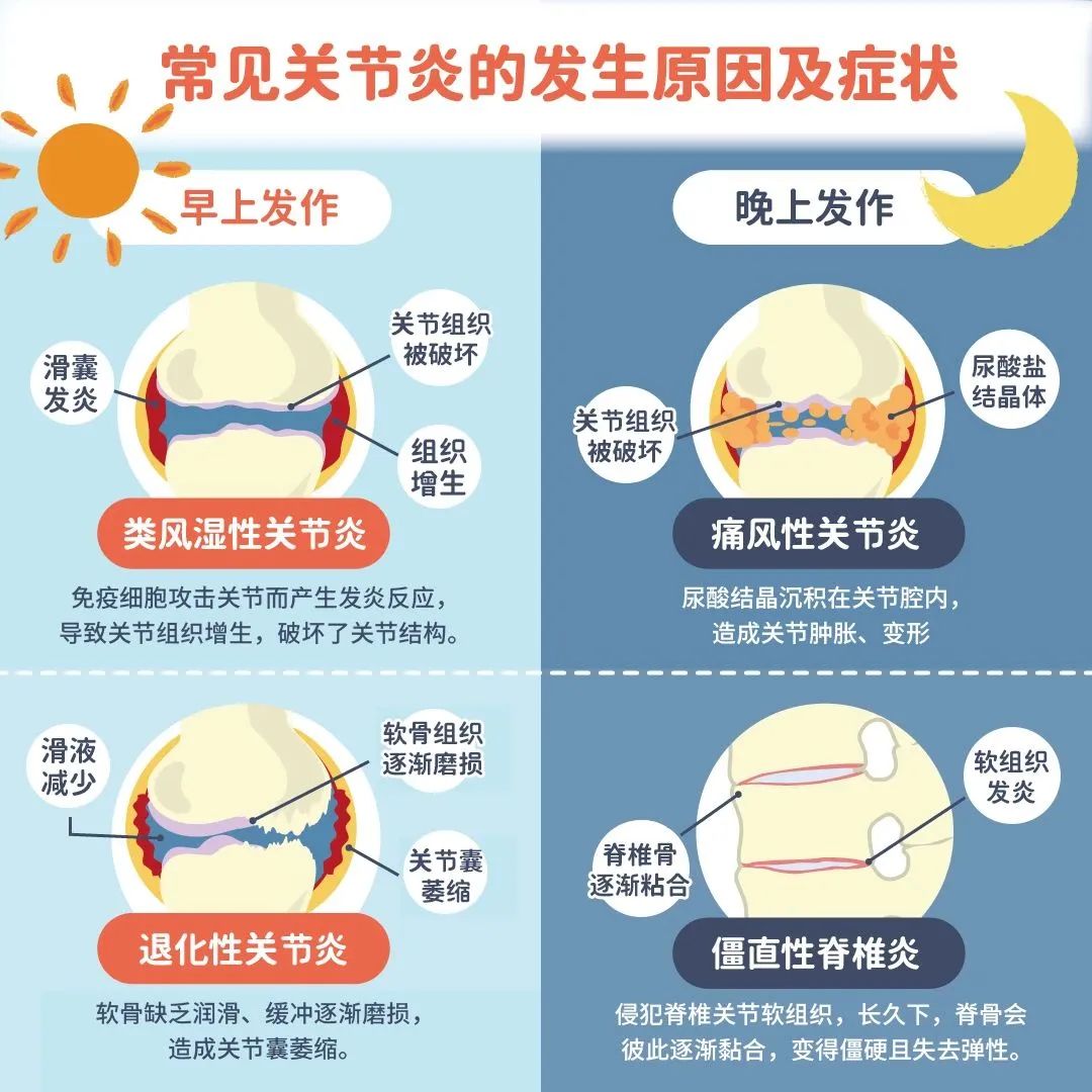 为什么会得关节炎呢为什么在线