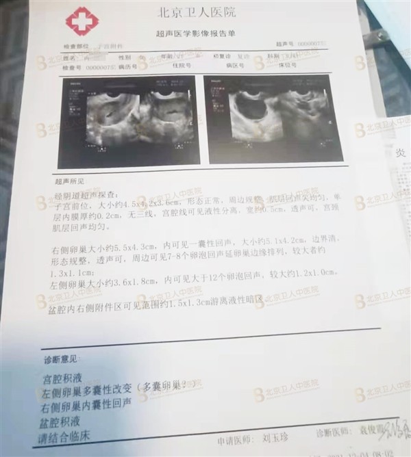 北京卫人中医院刘玉珍治多囊,用"医者父母心"践行医生的责任!