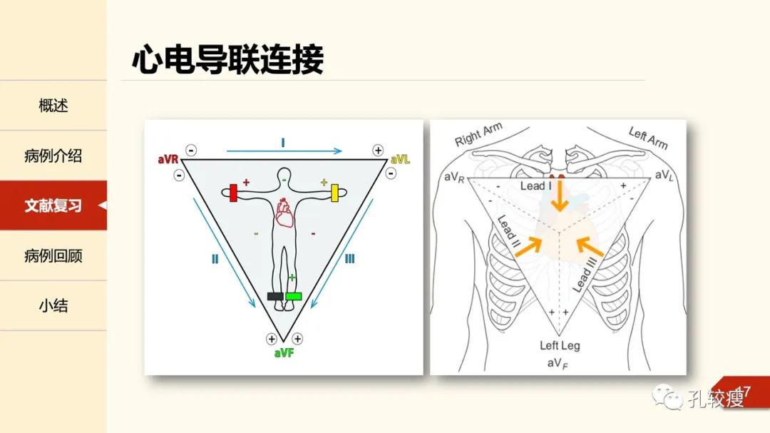 心脏导联接的位置图图片