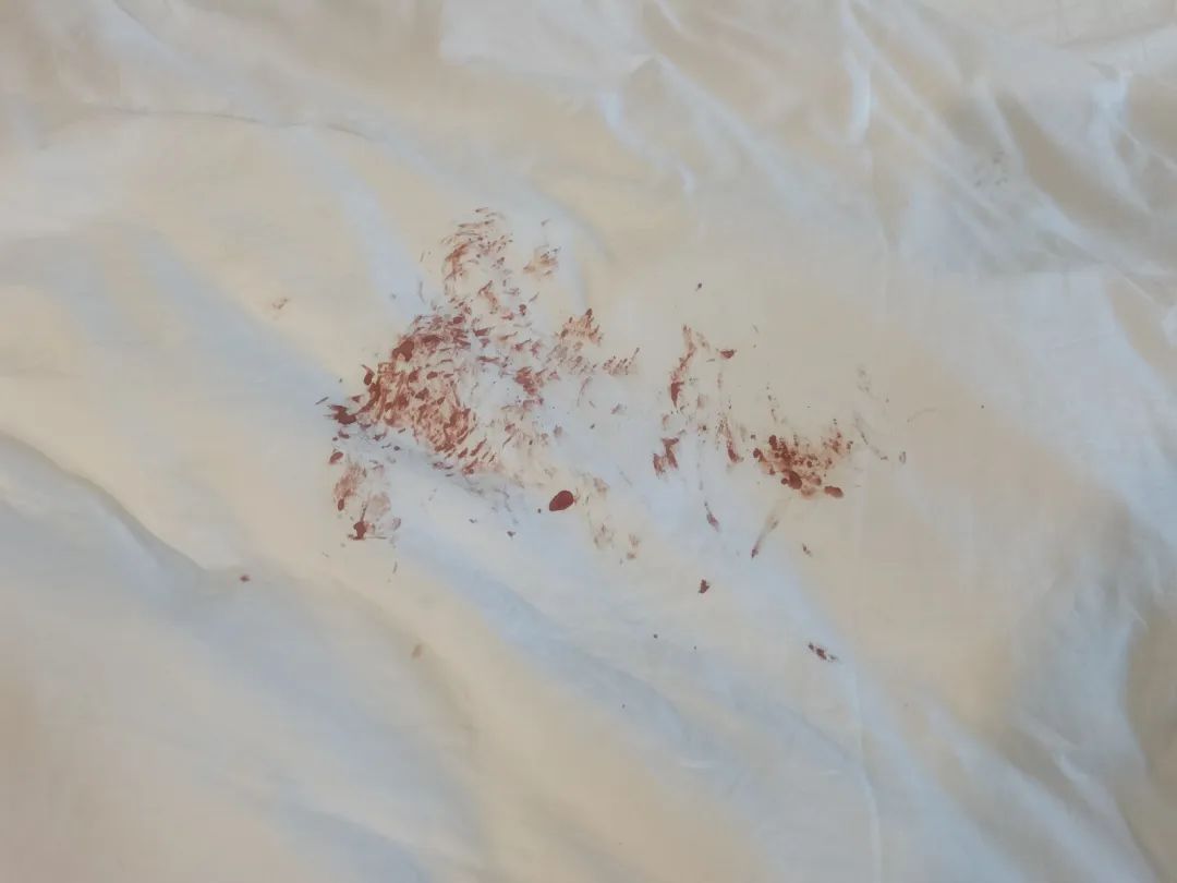 床单上有大片血迹图片图片