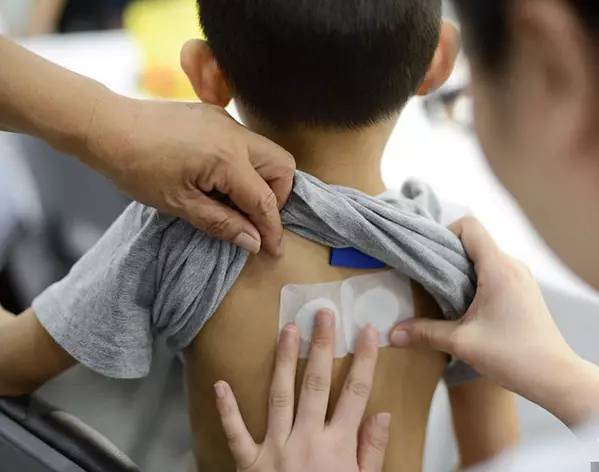 三伏贴|冬病夏治,别错过