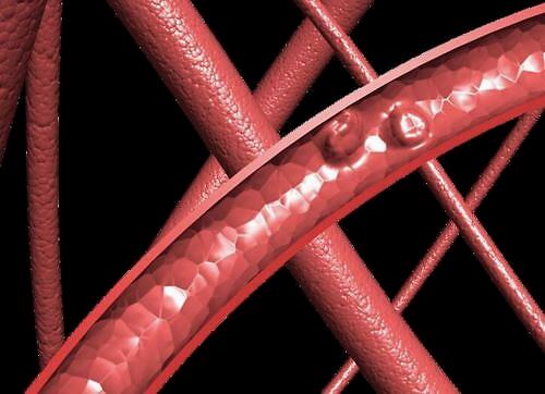 生姜配一物,时常喝点,血管干净又通畅,高血脂不攻自破