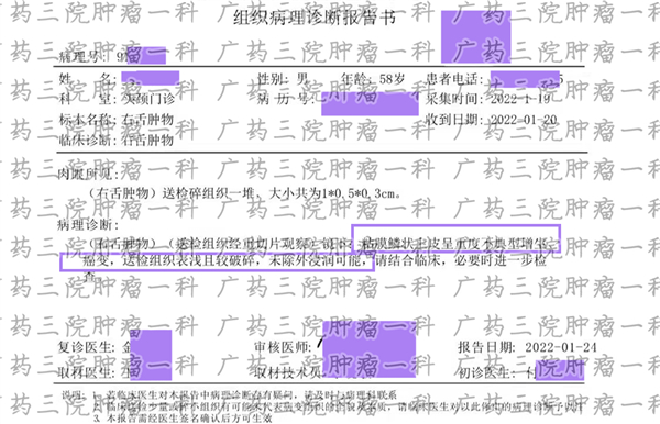 舌癌的治愈率是多少