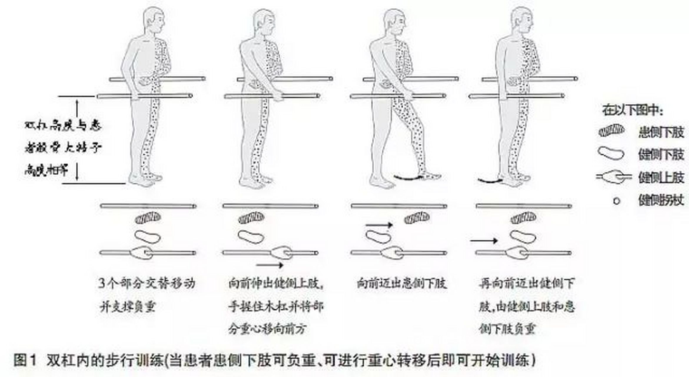 剪刀步态的康复训练图片