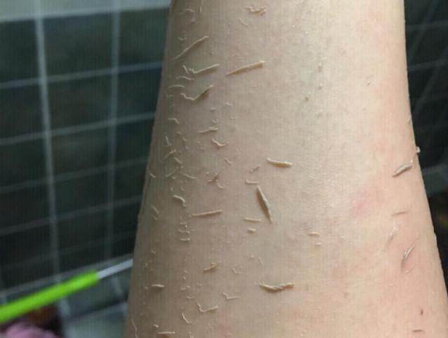 洗澡搓下来的灰到底是什么?用显微镜放大100倍观察,一起看看吧