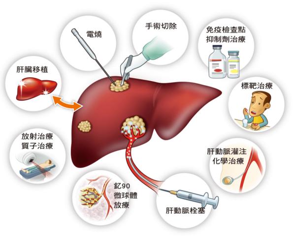 肝癌是什么原因引起的图片