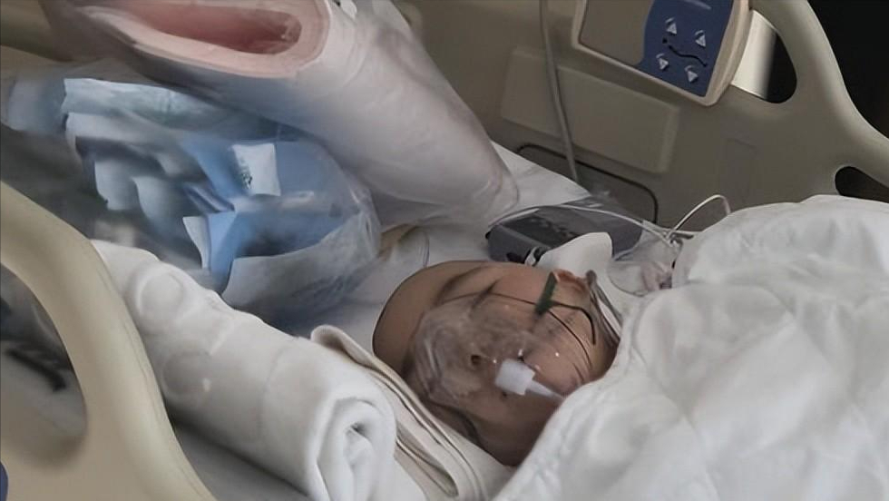 纪实:一岁半遭烟头烫腿,经历4次心脏骤停的小辛怡,如今怎样了