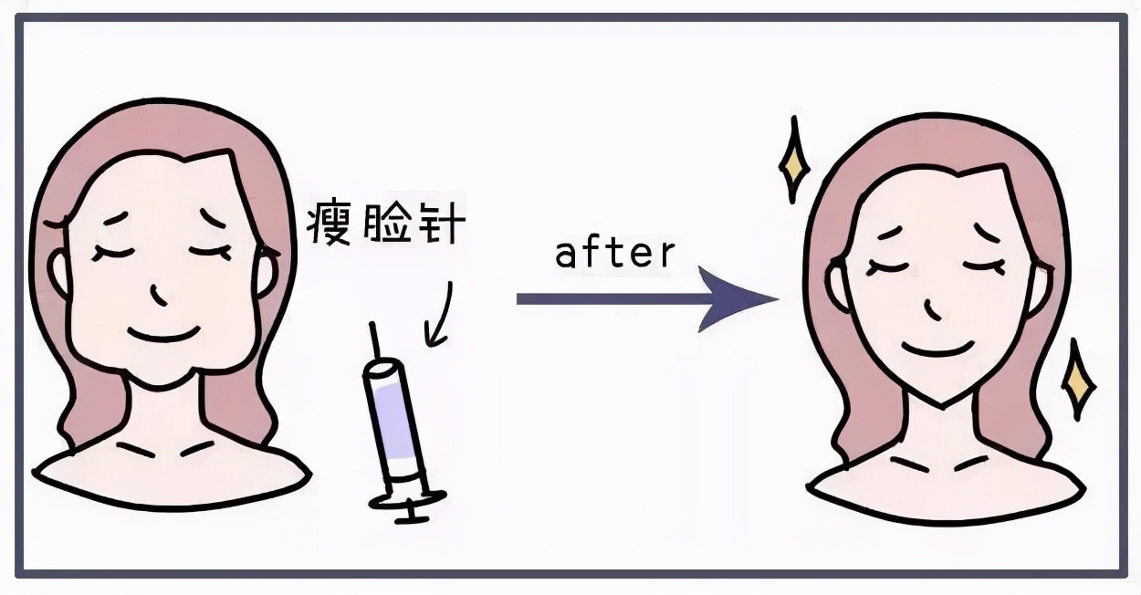 瘦脸针的优点有哪些?注射后需要留意什么?