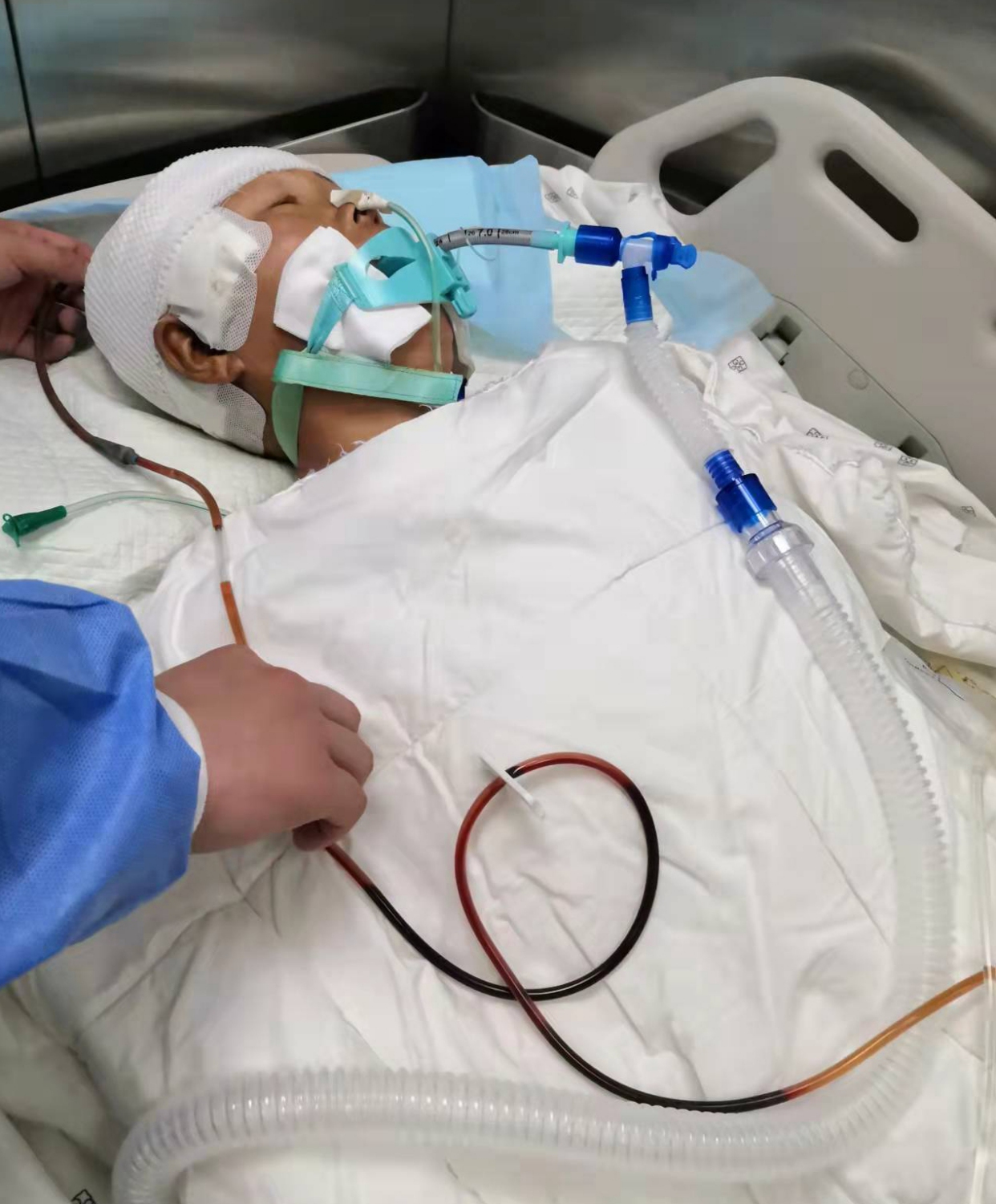 爱心接力!陕西50岁母亲不幸突发脑出血重症监护室尚未脱离危险!