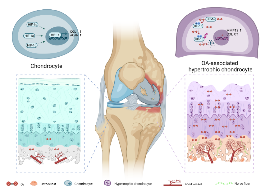 苏佳灿/陈晓/井莹莹团队揭示骨关节炎发生新机制