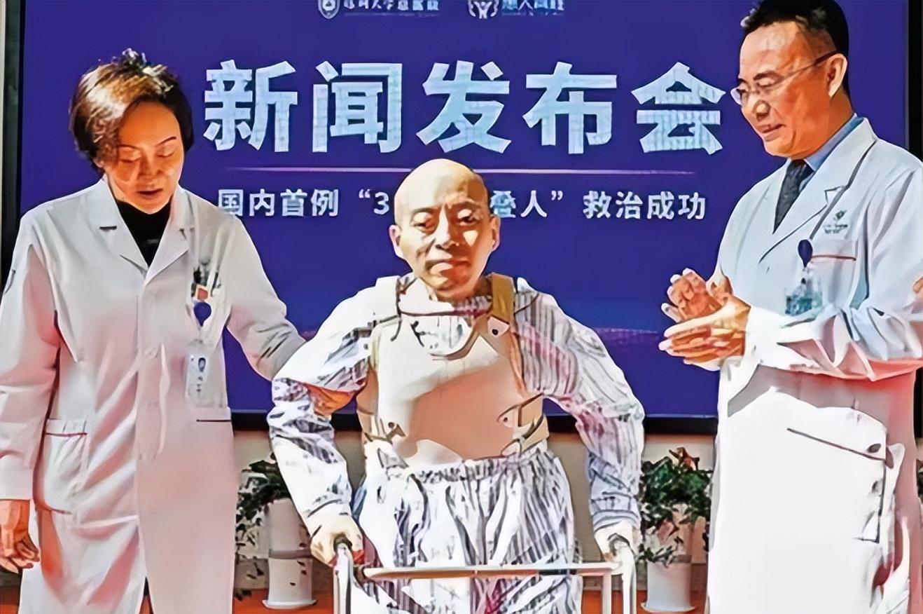 回顾身体被敲断4次的折叠人出院:他历尽千辛,只为成为普通人