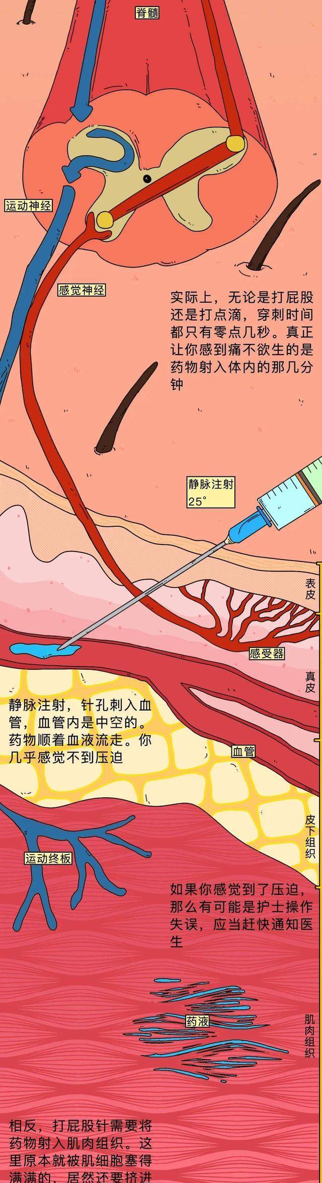 屁股针定位图片