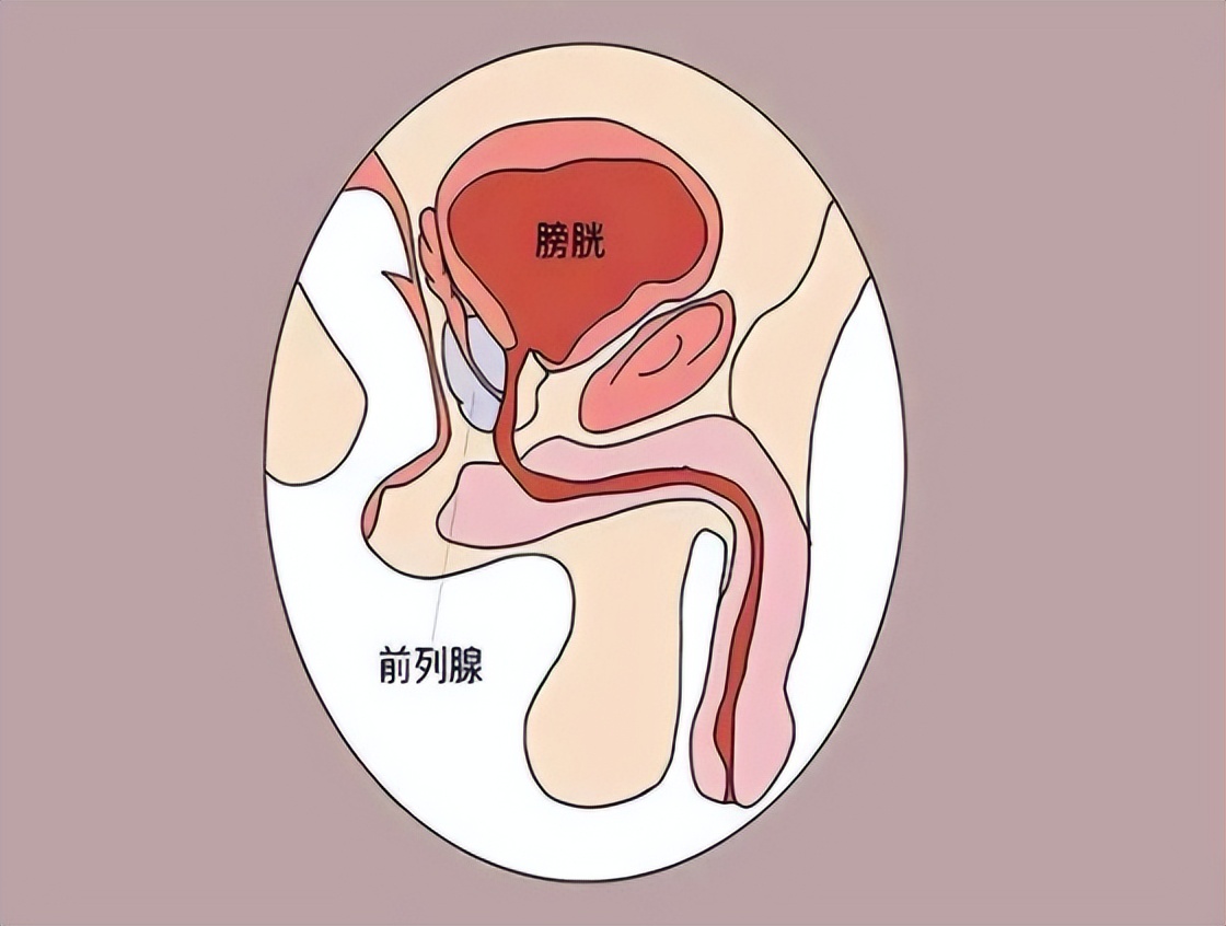 前列腺卡通图片图片