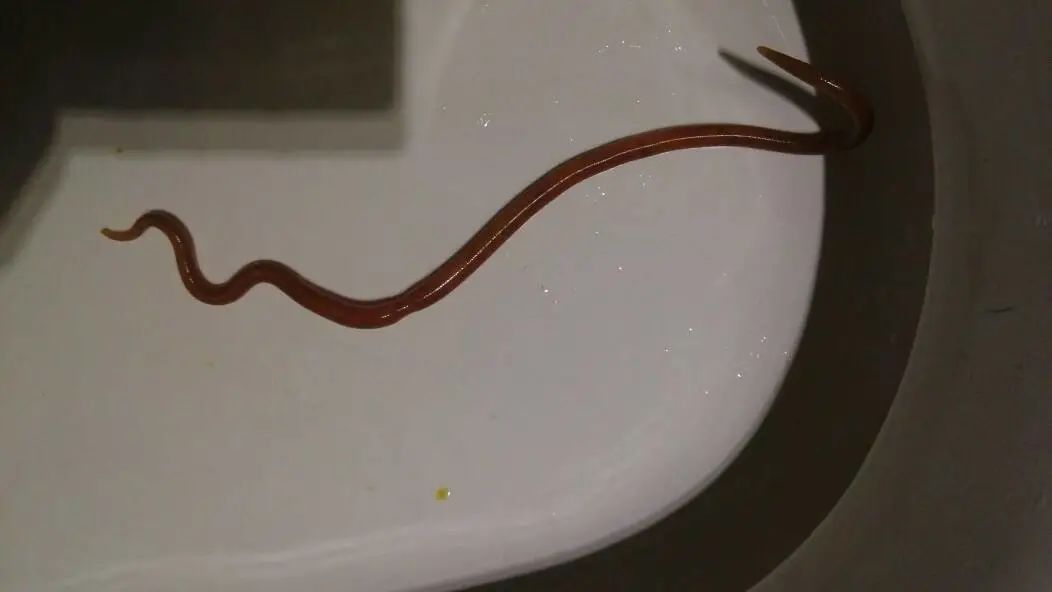 为何现在的小孩肚子里没蛔虫了?