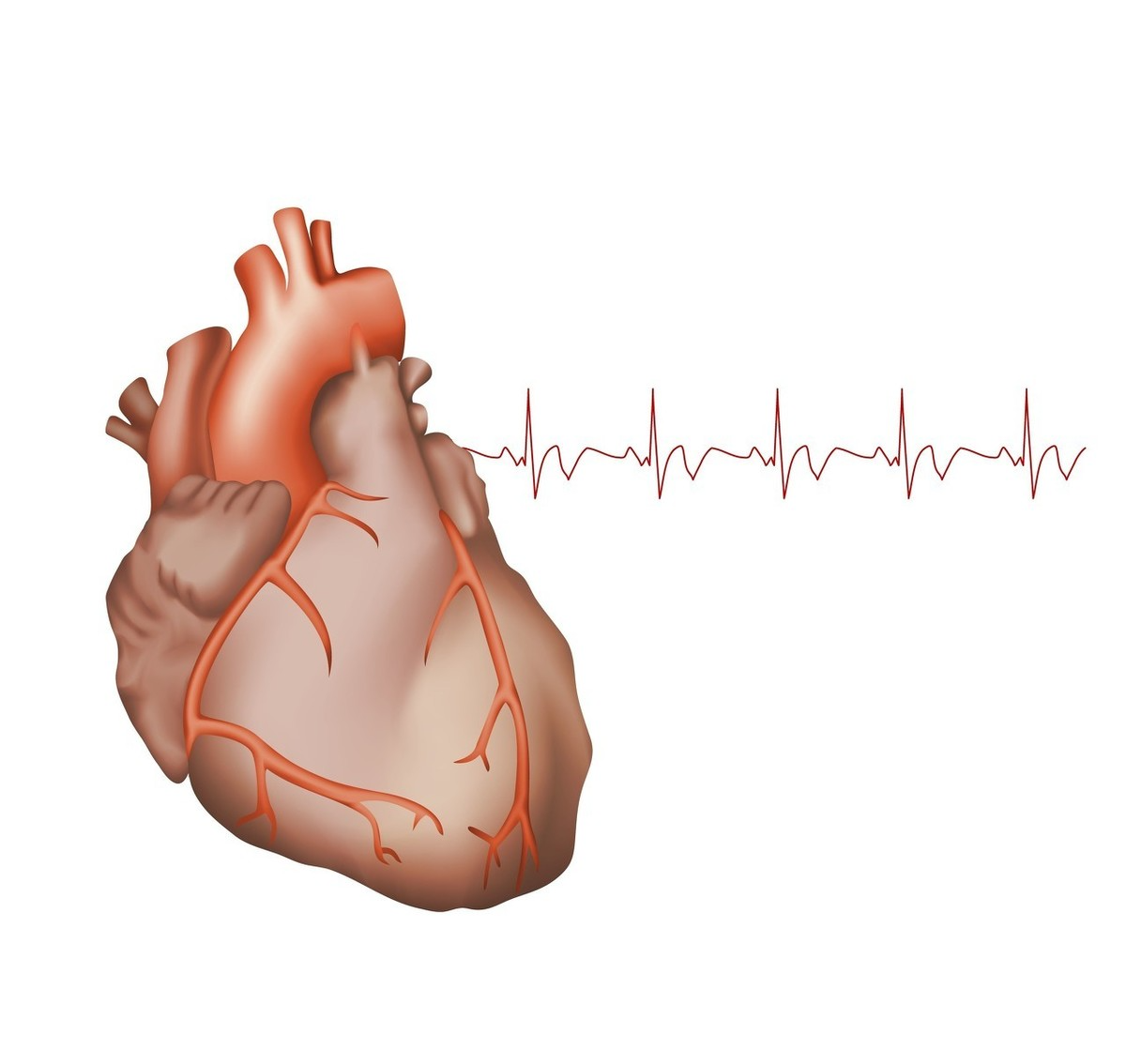 窦性心动过速的原因尚不明确,可能是由于自主神经对窦房结的调节