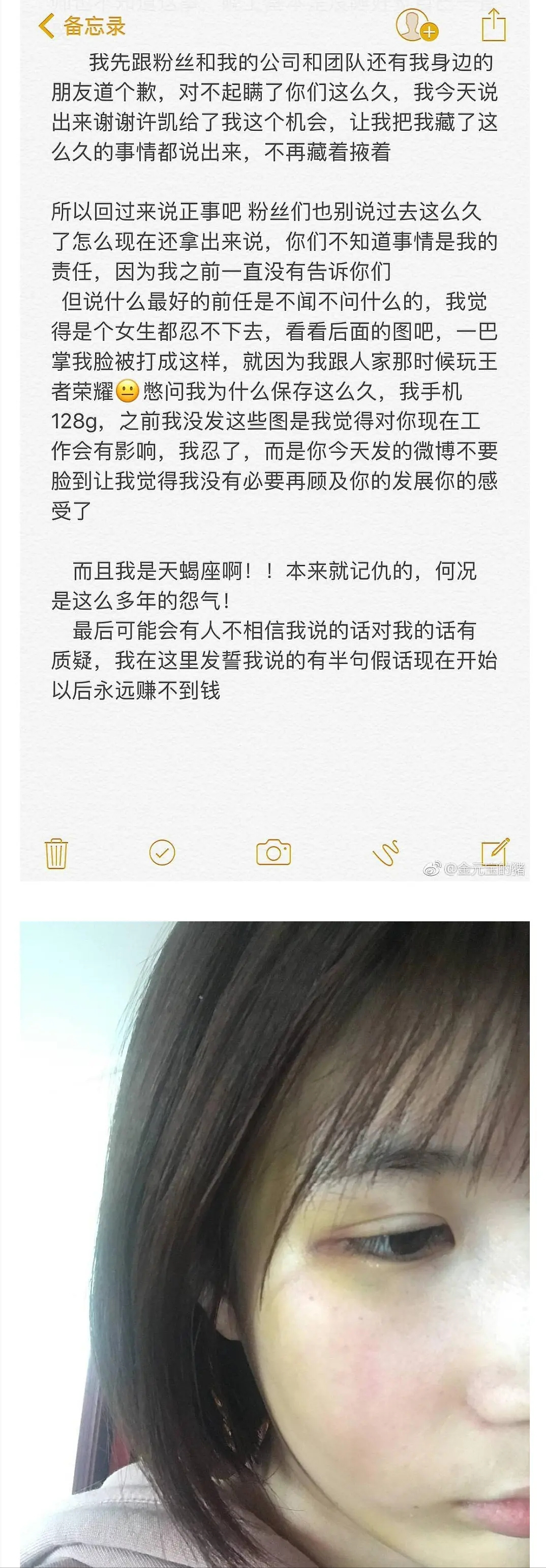 许凯前女友大金预告将重新回应家暴事件