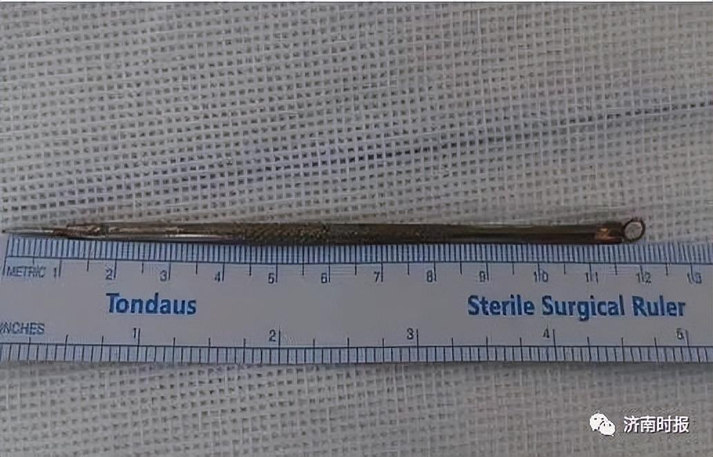 13岁男孩将12厘米长针塞进尿道,济南医生紧急救治