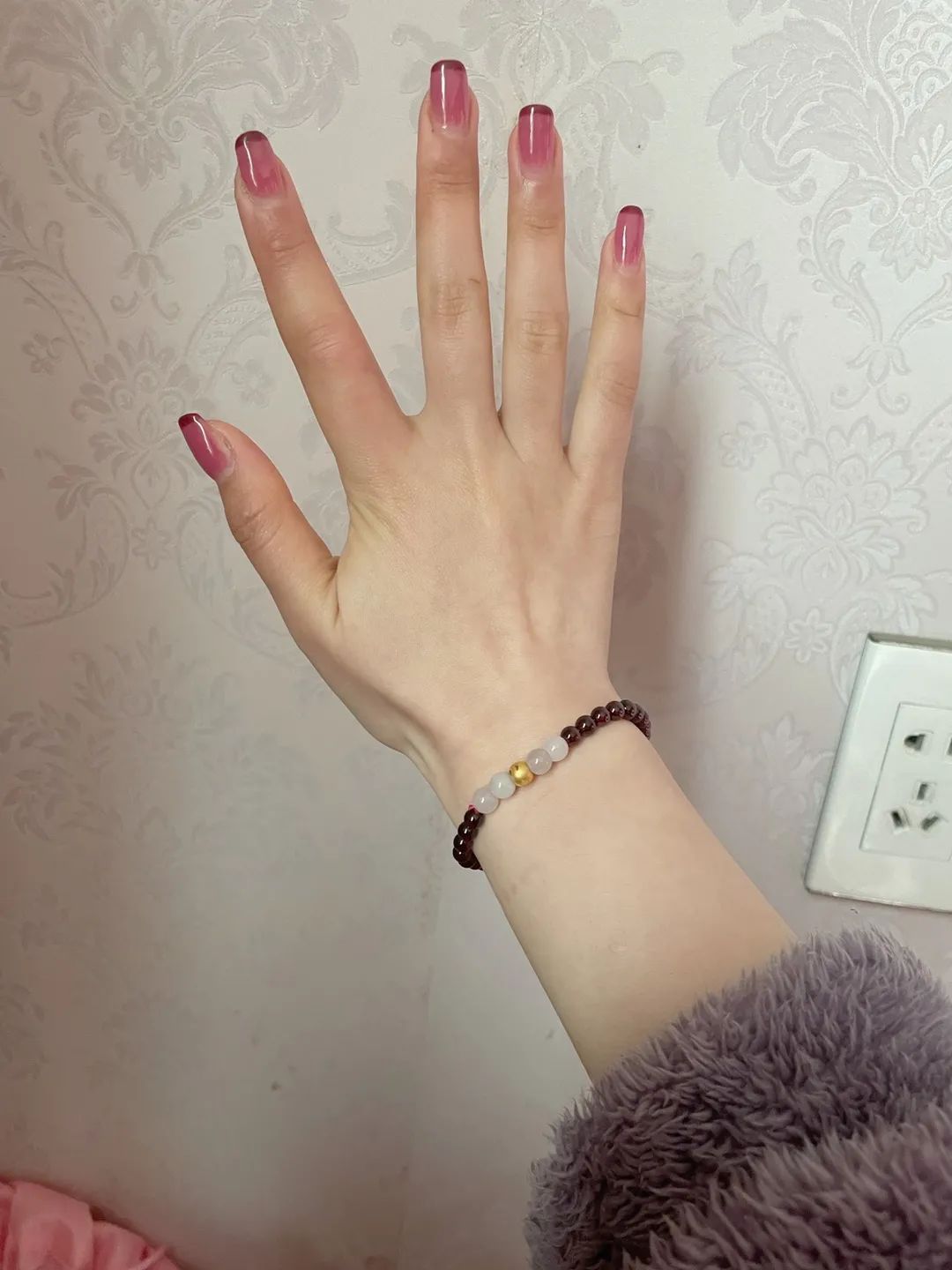 姑娘手上长了颗冻疮,一周后,事情变得有些严重了