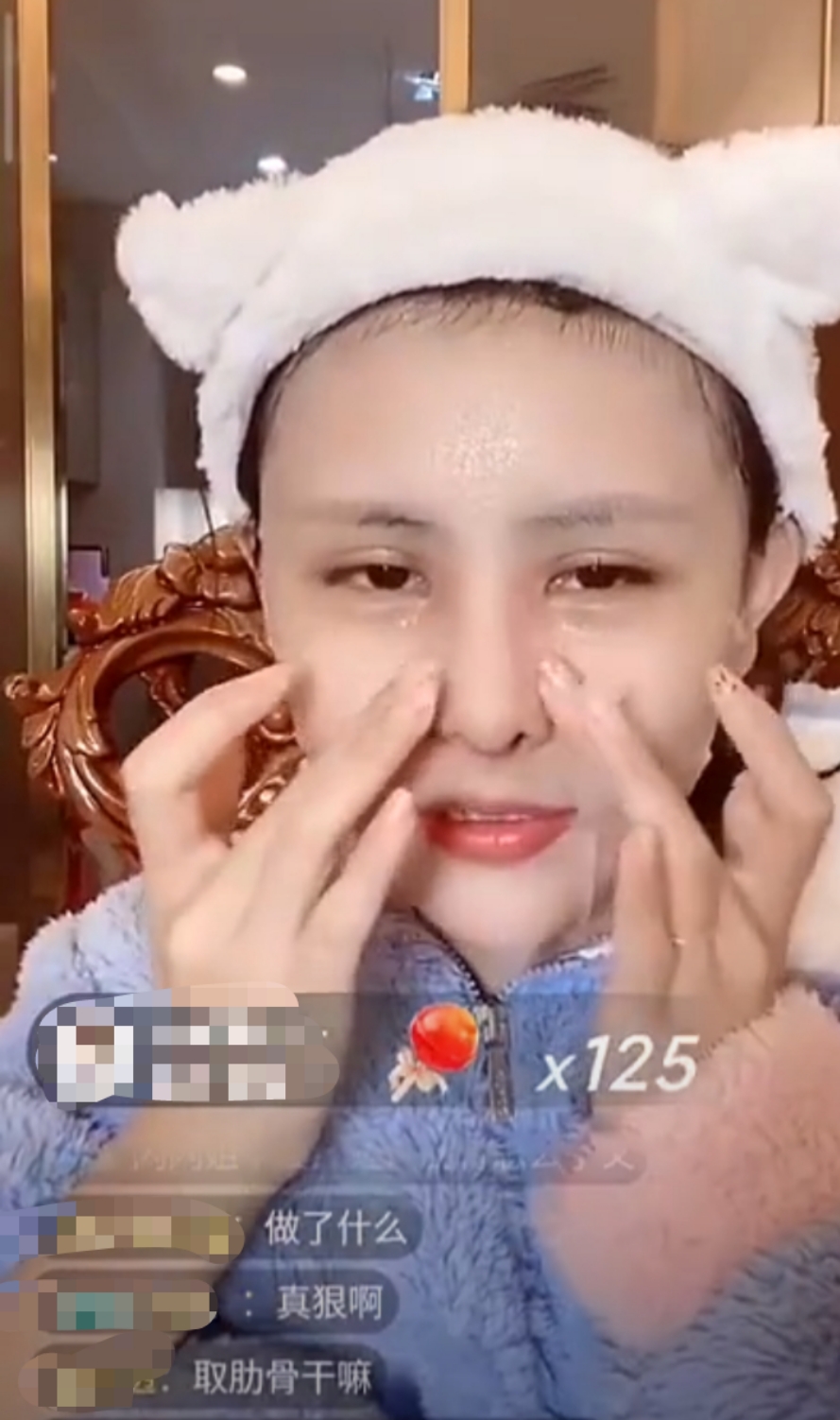 猫妹妹承认整容失败!多次被指不自然,取肋骨垫鼻子只因不自信