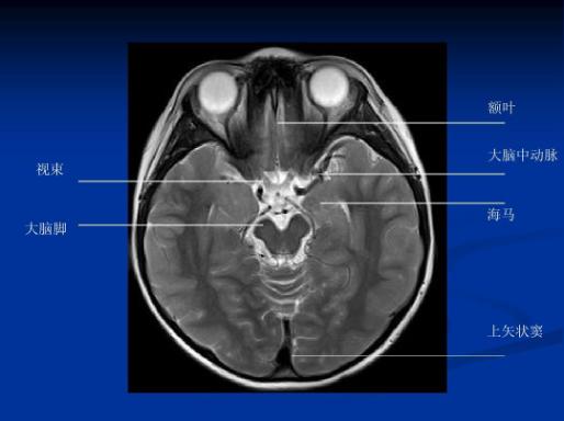 人人都有两只小海马,美好记忆全靠它