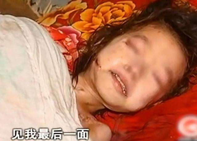 12岁女孩身体溃烂生蛆,亲生父亲:死了给她拖出去,甩了就是了