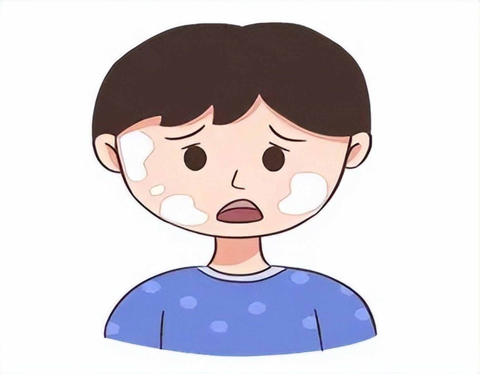 白癜风虽说