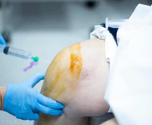 "封闭针"到底是什么?打了之后会有不良影响吗?不妨了解下