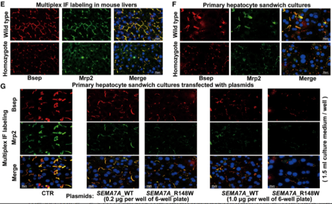 文章中多重荧光免疫组化图片