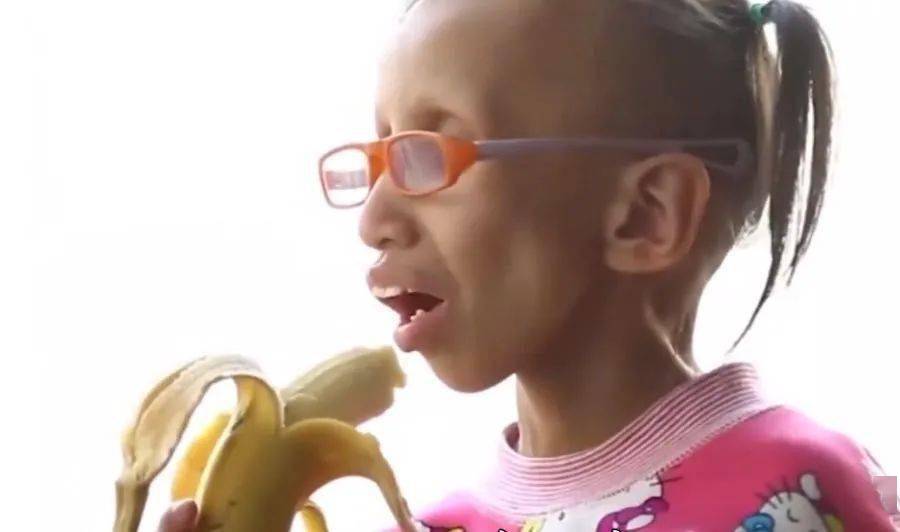 回顾:菲律宾女孩14岁参加选美,2年内满脸皱纹,外表像60岁比她妈老