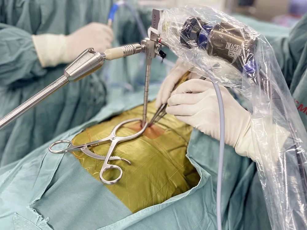 "切口越做越小,疗效越来越好"——儿中心成熟开展神经内镜辅助下极小