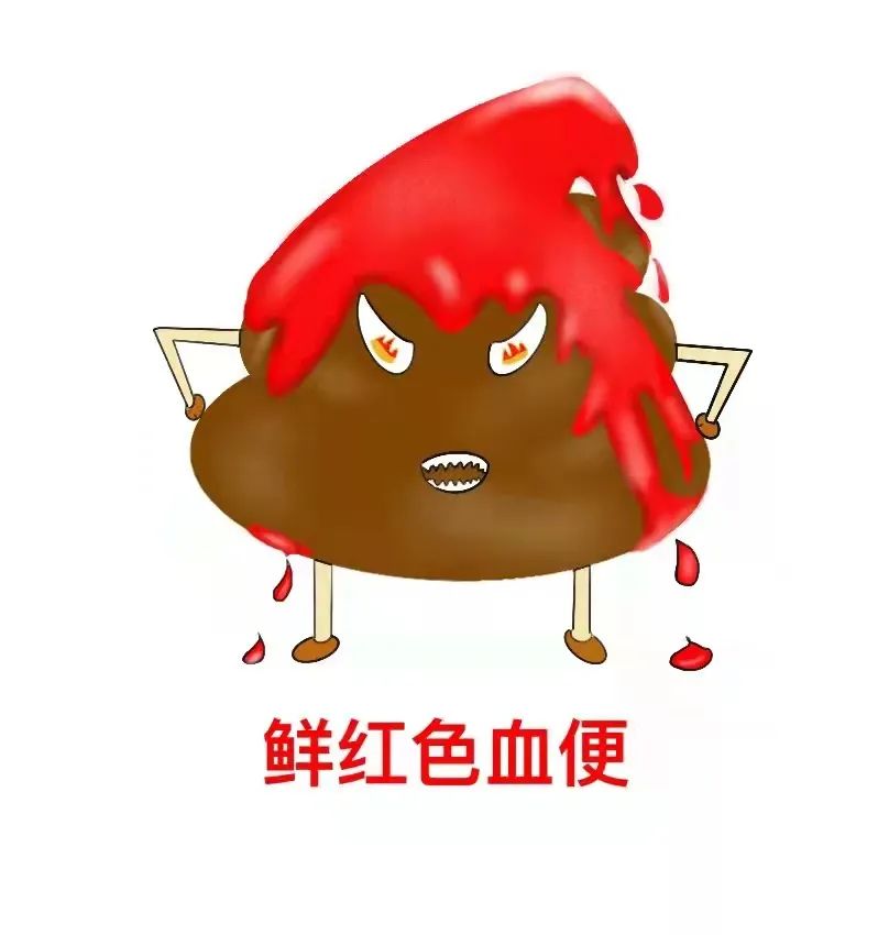 便血了可咋办!是痔疮还是癌?这里教您"见色识病"