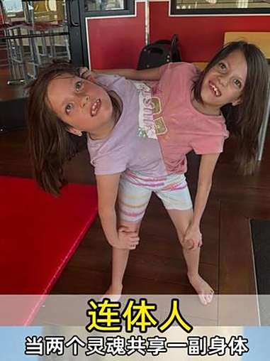 当两个灵魂共享一副身体 连体人 双胞胎